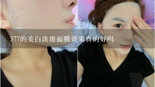 377的美白淡斑面膜效果真的好吗