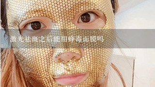 激光祛斑之后能用蜂毒面膜吗