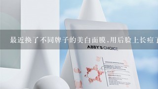 最近换了不同牌子的美白面膜,用后脸上长痘了