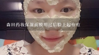 森田药妆保湿面膜用过后脸上起痘痘