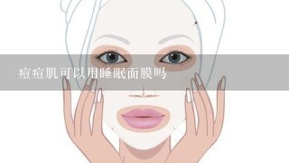 痘痘肌可以用睡眠面膜吗