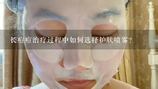 长痘痘治疗过程中如何选择护肤喷雾?